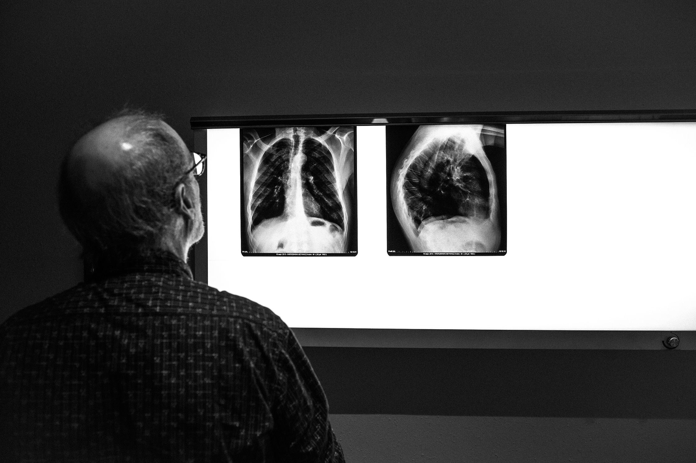 Handicap mental – 8/39